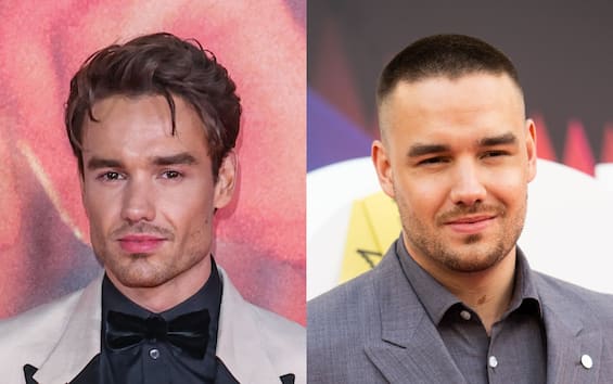 One Direction, Liam Payne Irriconoscibile Dopo La Chirurgia