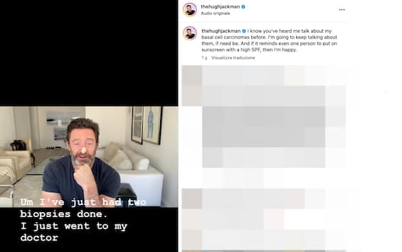 Hugh Jackman returns to talk about skin cancer: “I did two biopsies, protect yourself”