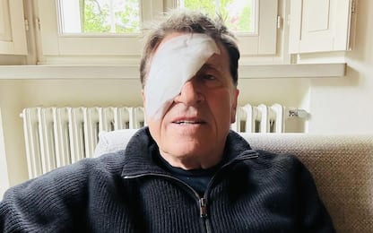 Gianni Morandi posa con una benda sull'occhio: cosa è successo