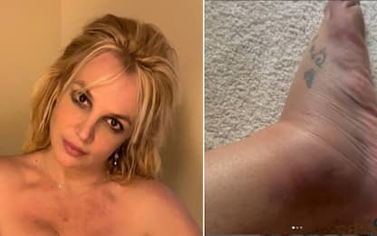 Britney Spears con la caviglia gonfia: "Sono caduta in soggiorno"