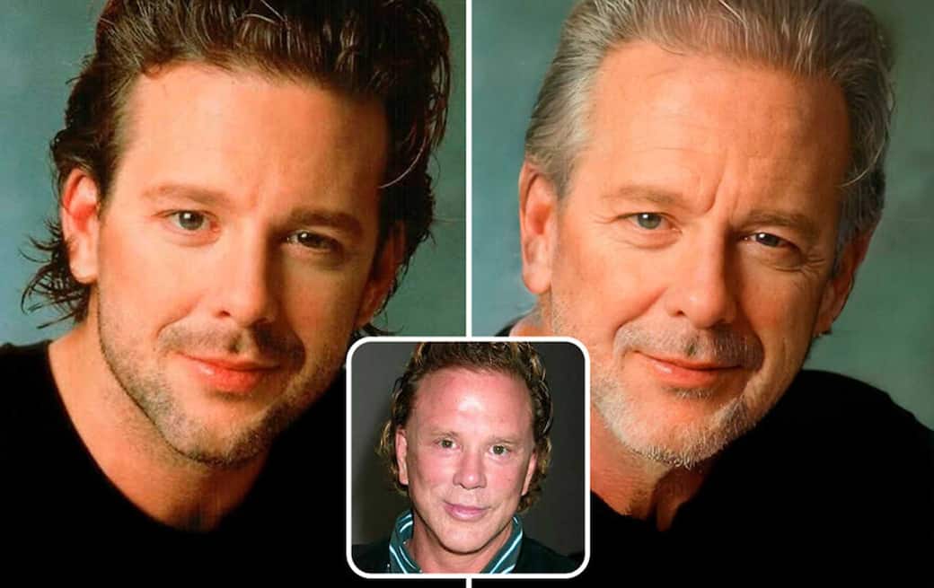 Da Madonna a Mickey Rourke, come sarebbero le star senza 'ritocchino'. FOTO