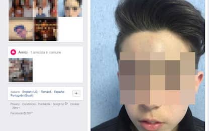 Tredicenne picchiato da bulli, padre pubblica foto su Facebook