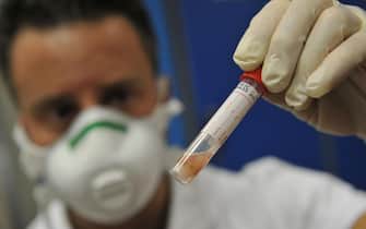 coronavirus focolai italia