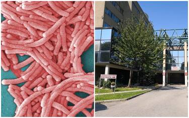 Legionella a Bresso, individuati 2 campioni positivi. 26 i contagiati