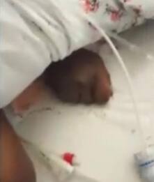 La donna sommersa dalle formiche all’ospedale di Napoli si è aggravata