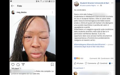 Bari, studentessa picchiata dall’ex pubblica le foto su Instagram