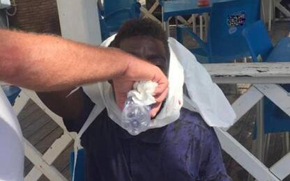 Migrante picchiato a bastonate da due ragazzi ad Anzio: un arresto