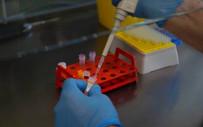 Coronavirus, DiaSorin riceve un finanziamento per sviluppare il test