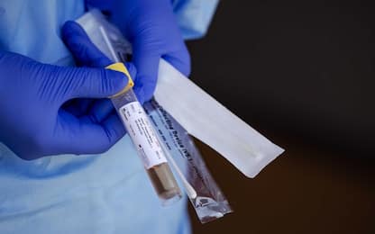 Coronavirus, Magrini: “Verso protocollo unico nazionale per più studi”