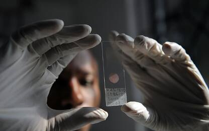 Oms, un rapporto lancia l'allarme sull'eradicazione della malaria