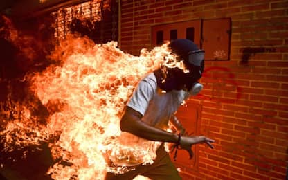 World Press Photo 2018, vince scatto dell'uomo in fiamme in Venezuela