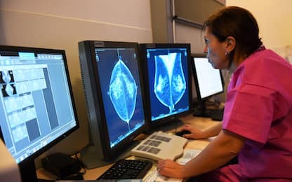 Tumore al seno, nuove speranze da una terapia con nanoparticelle