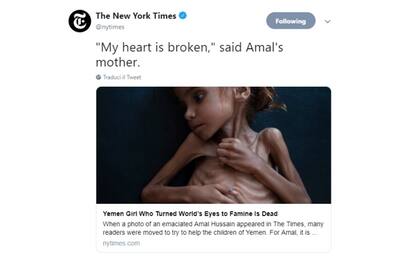 Addio Amal, la bambina simbolo dello Yemen