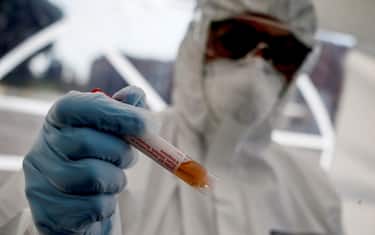 Coronavirus, in Italia è aumentata la carica virale nei tamponi