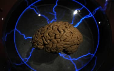 La pressione più alta di notte può aumentare il rischio di Alzheimer
