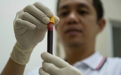 Sclerosi multipla, test sul sangue potrebbe agevolare le diagnosi