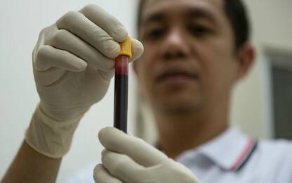 Leucemia, un test del sangue può anticipare la diagnosi