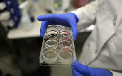 Tumori, scoperta in Italia causa effetti collaterali terapia genica