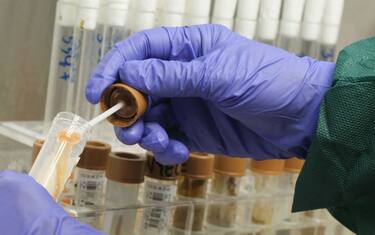Superbatteri, scoperto il segreto della resistenza agli antibiotici