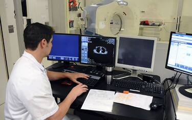 Tumore al polmone: i sintomi, le cause, le cure