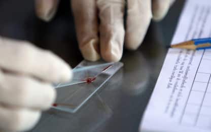 Malaria, in Italia 726 casi all'anno