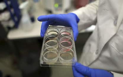 Creata una nuova classe di antibiotici contro i batteri resistenti