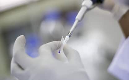 Cremona, donna di 34 anni muore di meningite