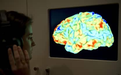I ‘segreti’ del cervello degli adolescenti svelati da uno studio