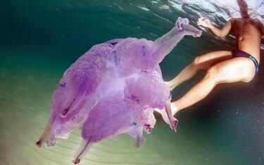 Meduse, cosa fare in caso di puntura