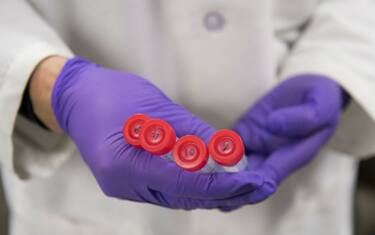 GettyImages-analisi_del_sangue