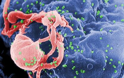 Aids, scoperto nuovo ceppo virale dell'Hiv