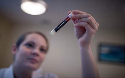Coronavirus, Avis: “Nessun rischio per i donatori di sangue”