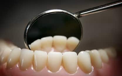 Cura dentale: addio carie grazie a nuovo materiale con antibatterico