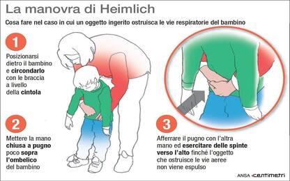 Manovra di Heimlich, come eseguirla nei bambini e negli adulti