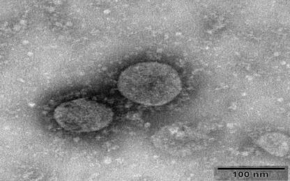 Cina, pubblicate le prime immagini del coronavirus. FOTO