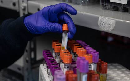 Creato un test del sangue che può scoprire 50 diversi tumori