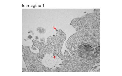 Le prime immagini al microscopio del virus lombardo isolato al Sacco