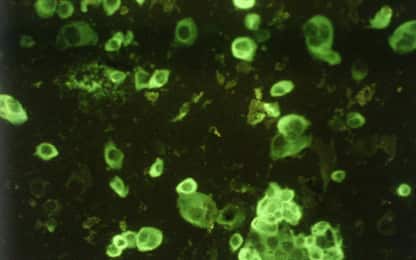 Un nuovo microrganismo avvicina la scienza all’origine della vita