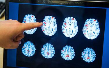 Cervello: perché con l'età nascono meno neuroni?