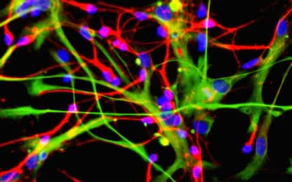 Scoperto un nuovo neurone che assomiglia a una rosa senza petali