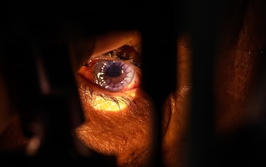 Creato un occhio artificiale in 3D con cellule umane