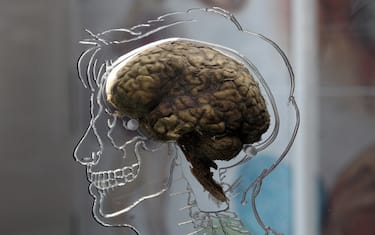 Il pensiero negativo ripetitivo può essere legato a rischio di demenza