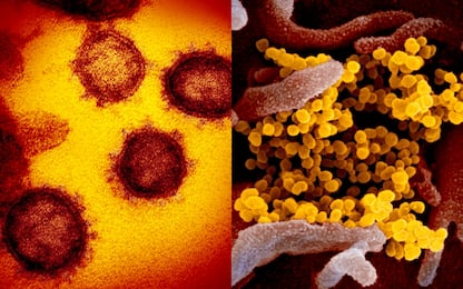 Coronavirus, ritratto dettagliato in 5 nuove immagini. FOTO