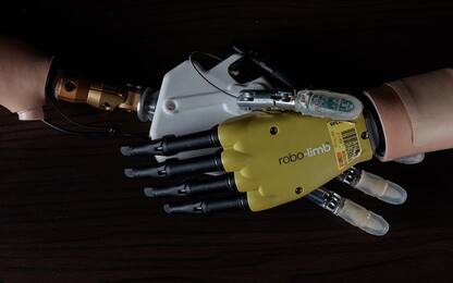 Hannes, la mano robotica che ha vinto il premio per l’innovazione ADI
